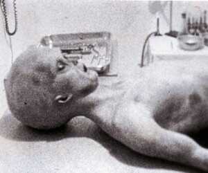 alien autopsy